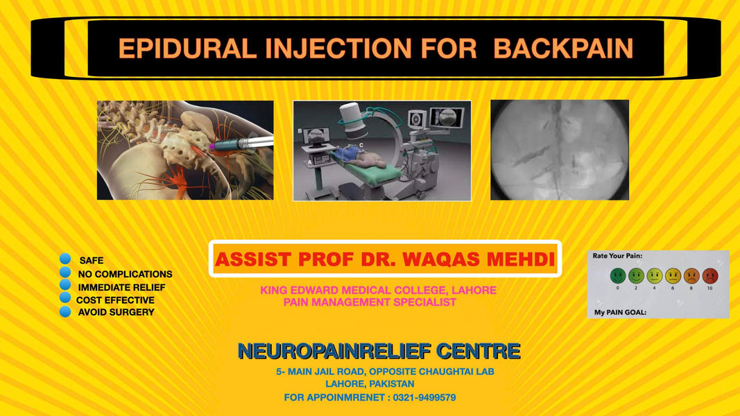 epidural injection for pain relief